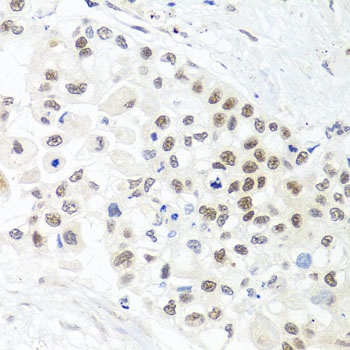 TRMT1 Antibody
