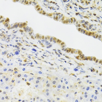 EFTUD2 Antibody