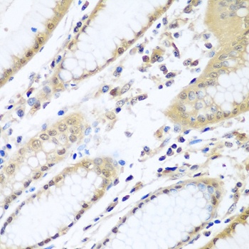 WDR48 Antibody