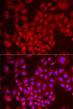 DCAF7 Antibody