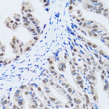 MTA3 Antibody