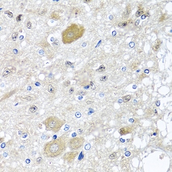 CST1 Antibody