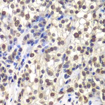 CENPC Antibody