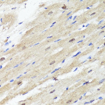 ACSS2 Antibody