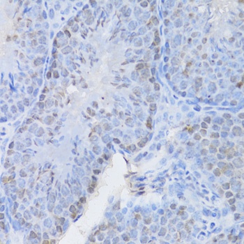 CBX8 Antibody