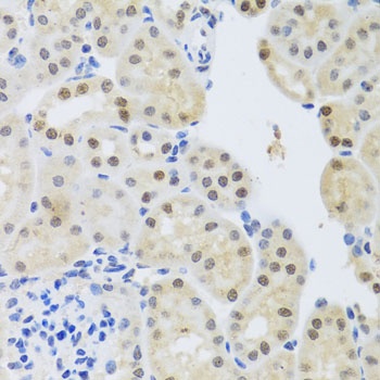 SET Antibody