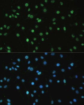 SET Antibody