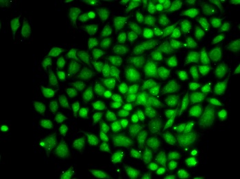 CTCFL Antibody