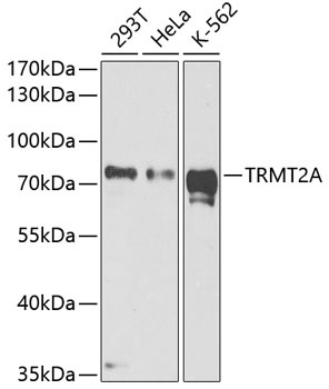 TRMT2A Antibody