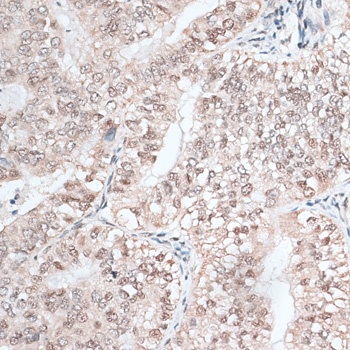 RBM3 Antibody