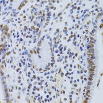 XRCC5 Antibody