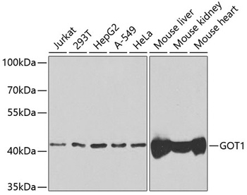 GOT1 Antibody