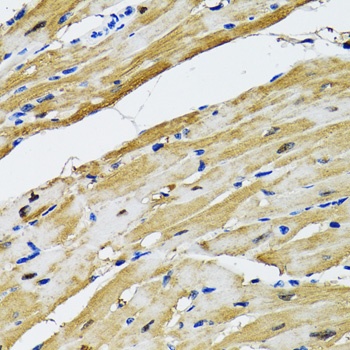 GOT1 Antibody