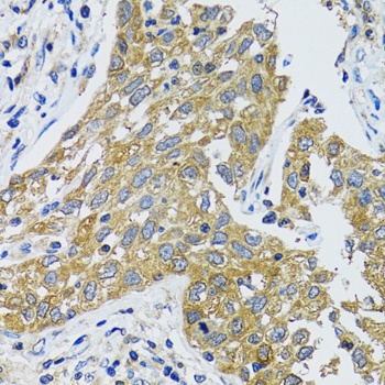 GOT1 Antibody