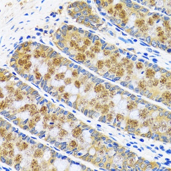 GOT1 Antibody