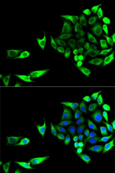 GOT1 Antibody