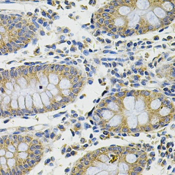 DDX20 Antibody