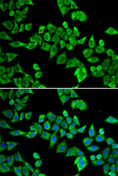 DDX20 Antibody