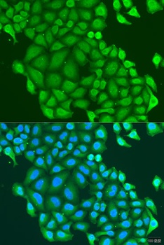 HAUS6 Antibody