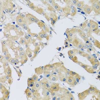 ABCF2 Antibody