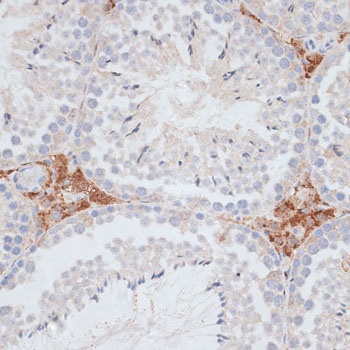 KIFC1 Antibody