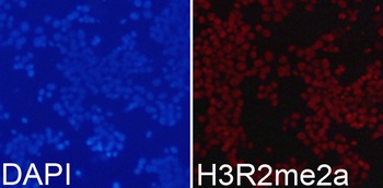 H3R2me2a Antibody