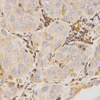 KLK5 Antibody
