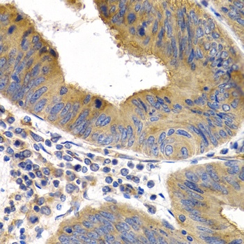 HSPB8 Antibody