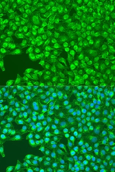 SYK Antibody