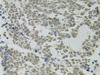 PPP4C Antibody