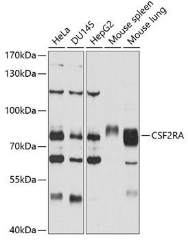 CSF2RA Antibody
