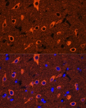 TUBB3 Antibody