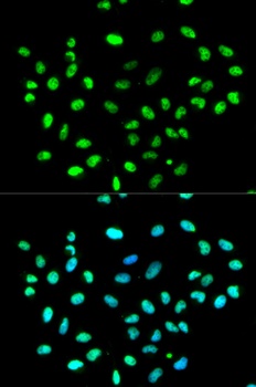 HNRNPK Antibody