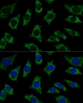 ETFB Antibody