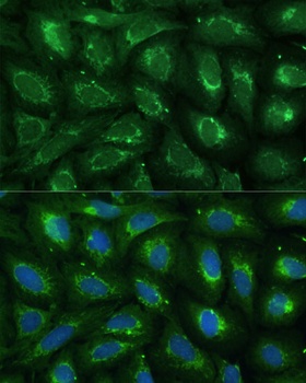 ABCD2 Antibody