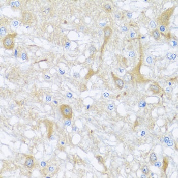 SULT1A1 Antibody