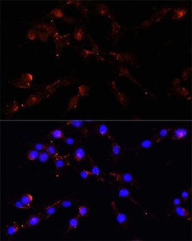 VDAC1 Antibody