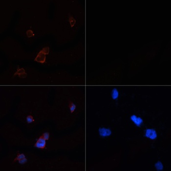 ACACA Antibody