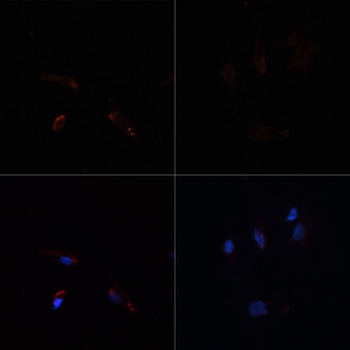 ACACA Antibody