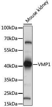 VMP1 Antibody