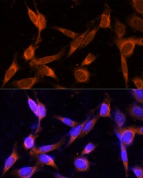 VMP1 Antibody