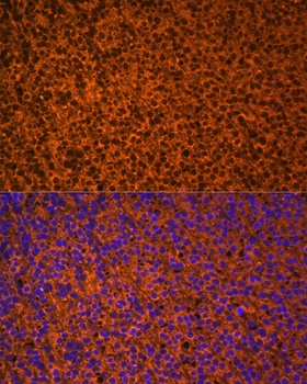 PTCH1 Antibody