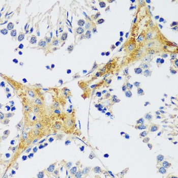 CAMK1 Antibody