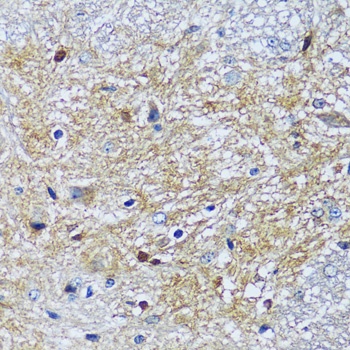 CAMK1 Antibody