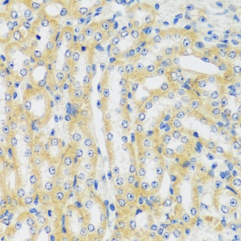 CAMK1 Antibody