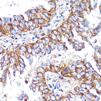 CNR1 Antibody