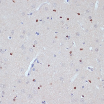 ESRRA Antibody