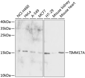 TIMM17A Antibody
