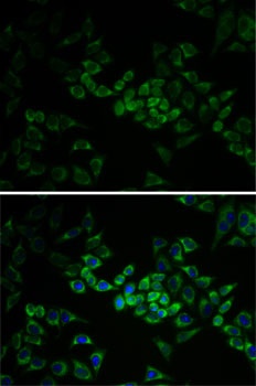 AK1 Antibody