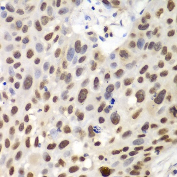 GNB2L1 Antibody